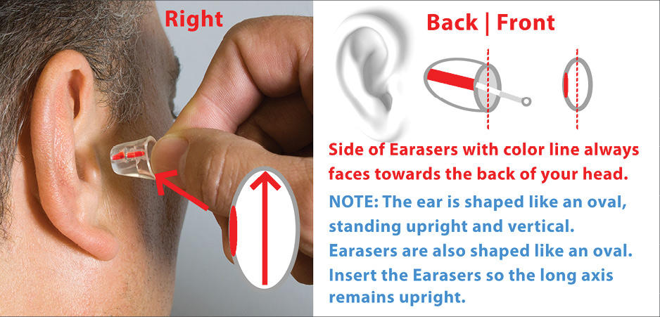 Earasers Earplugs for Musicians and Concertgoers - Standard Filter - Small - Bananas at Large®